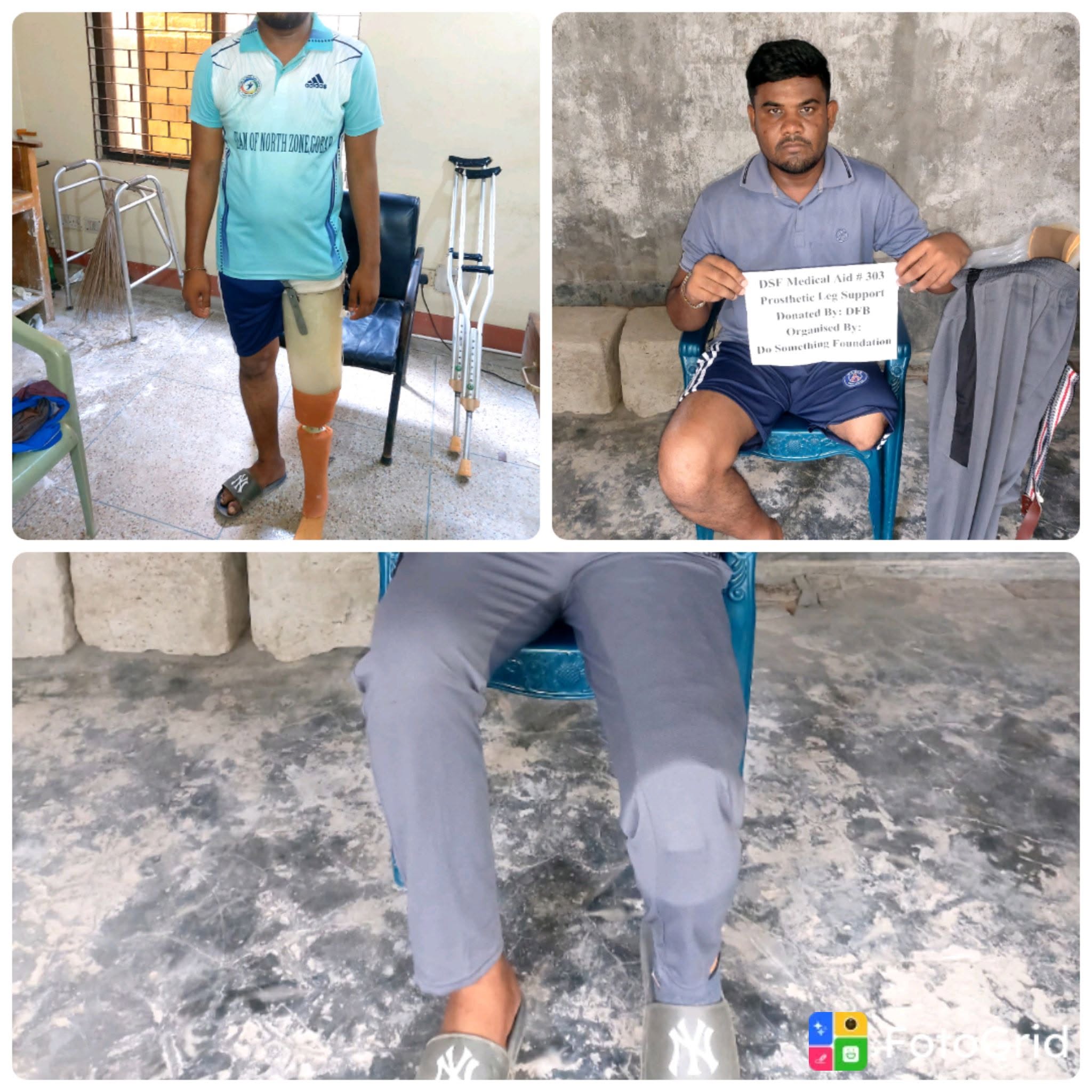 DSF Provides an Artificial Leg to Help Road Accident Survivor Shamim Rebuild His Life